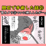 胆石で手術した話㉑「胃カメラ④ついに挿入したが…」