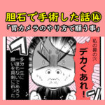 胆石で手術した話⑭「胃カメラのやり方で願う事」